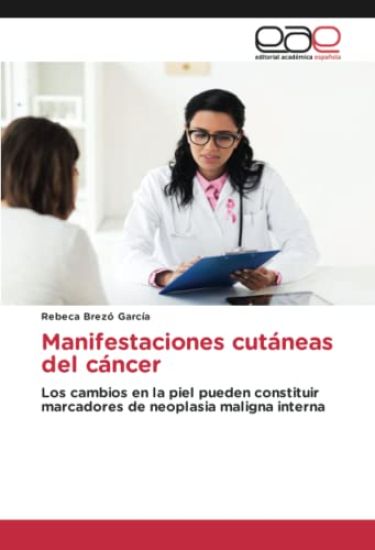 Manifestaciones cutáneas del cáncer