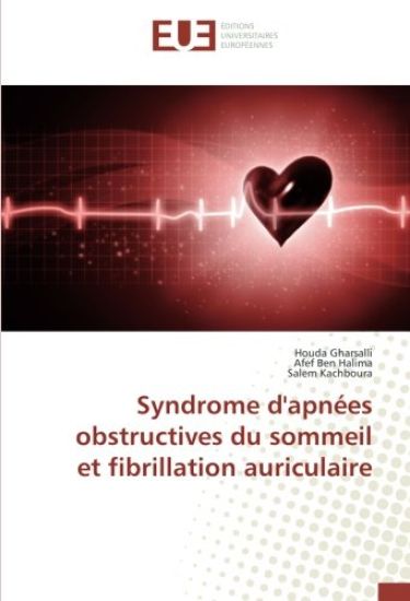 Syndrome d'apnées obstructives du sommeil et fibrillation auriculaire