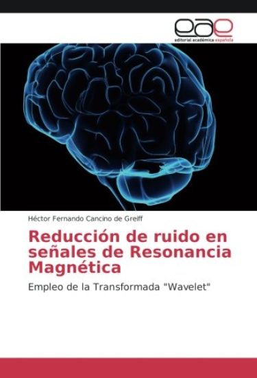 Reducción de ruido en señales de Resonancia Magnética