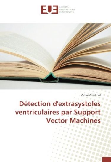 Détection d'extrasystoles ventriculaires par Support Vector Machines