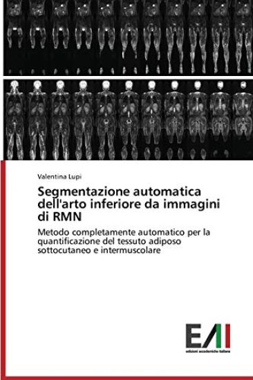 Segmentazione Automatica Dell'arto Inferiore Da Immagini Di Rmn