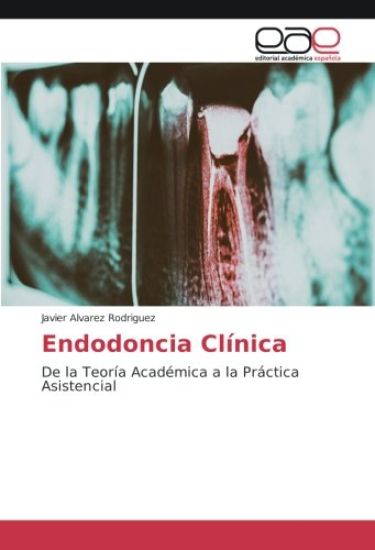 Endodoncia Clínica