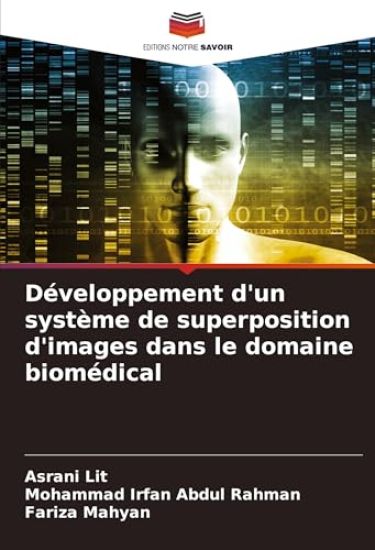 Développement d'un système de superposition d'images dans le domaine biomédical