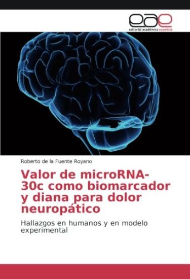 Valor de microRNA-30c como biomarcador y diana para dolor neuropático