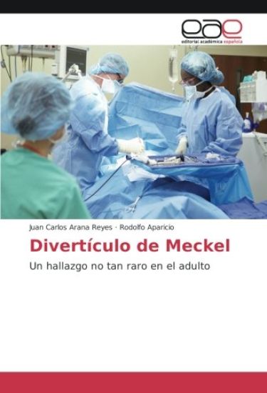 Divertículo de Meckel