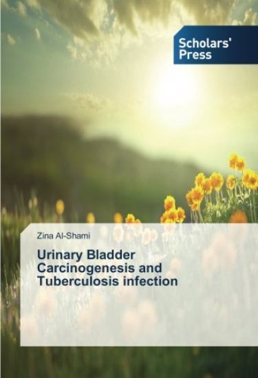 Urinary Bladder Carcinogenesis and Tuberculosis infection