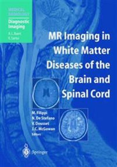 MR Imaging in White Matter Diseases of the Brain and Spinal Cord