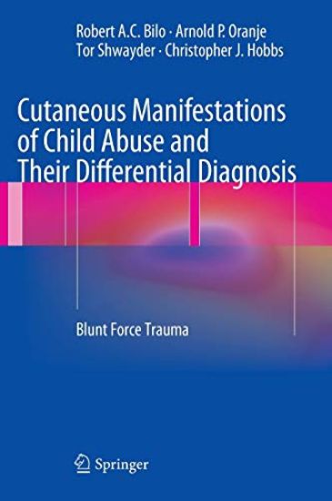 Cutaneous Manifestations of Child Abuse and Their Differential Diagnosis