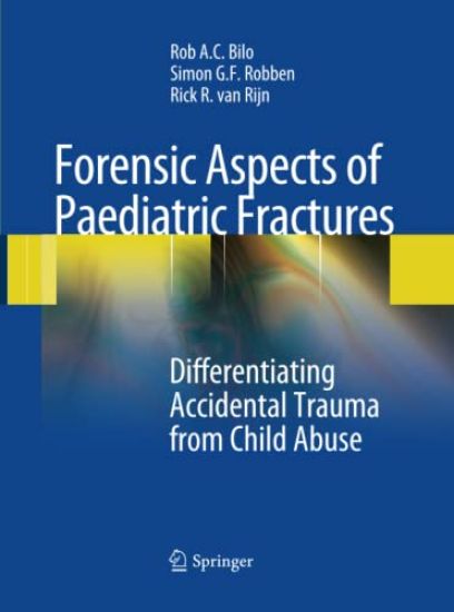 Forensic Aspects of Pediatric Fractures