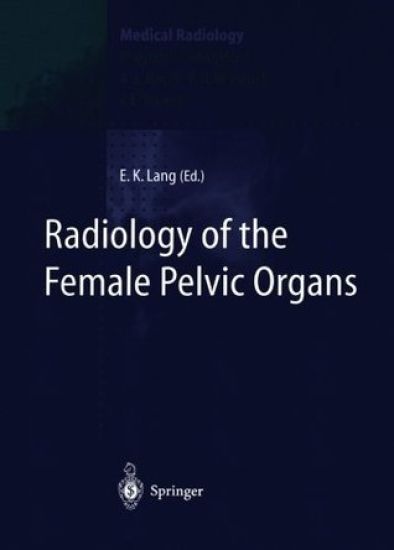 Radiology of the Female Pelvic Organs