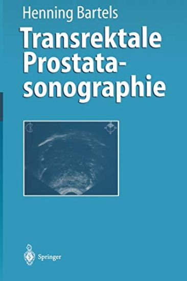 Transrektale Prostatasonographie