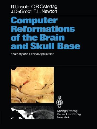 Computer Reformations of the Brain and Skull Base