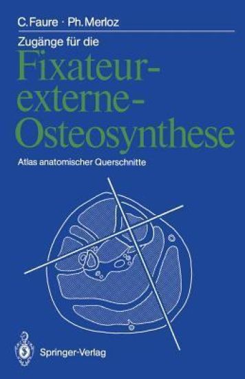 Zugänge für die Fixateur-externe-Osteosynthese
