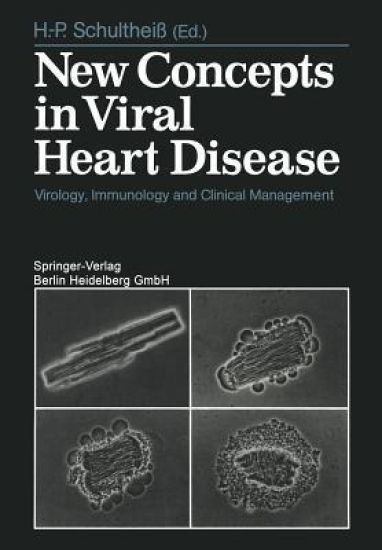 New Concepts in Viral Heart Disease