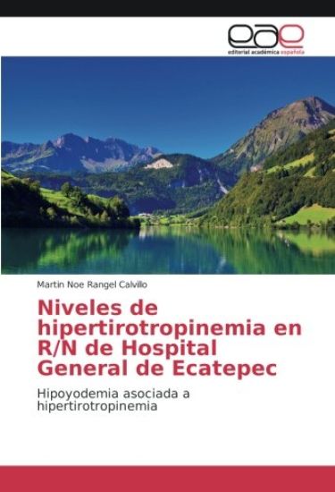 Niveles de hipertirotropinemia en R/N de Hospital General de Ecatepec