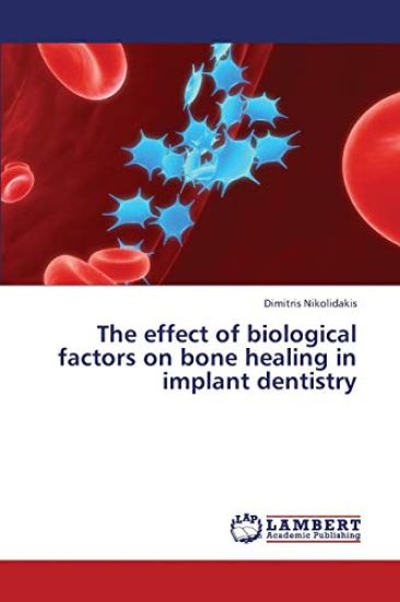 The Effect of Biological Factors on Bone Healing in Implant Dentistry