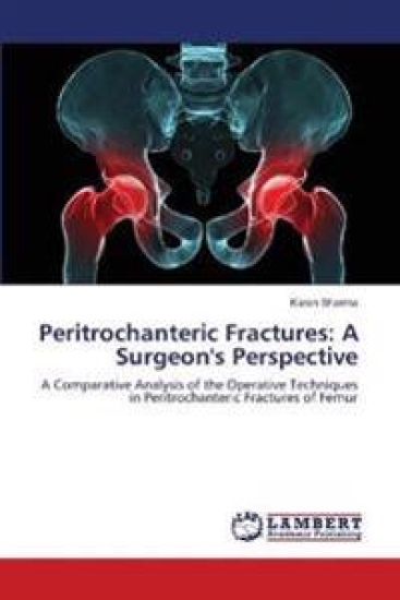 Peritrochanteric Fractures
