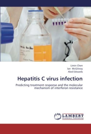 Hepatitis C virus infection