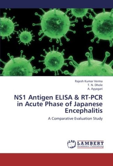 NS1 Antigen ELISA & RT-PCR in Acute Phase of Japanese Encephalitis