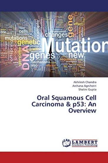 Oral Squamous Cell Carcinoma & P53