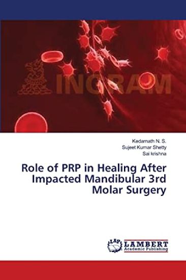 Role of PRP in Healing After Impacted Mandibular 3rd Molar Surgery