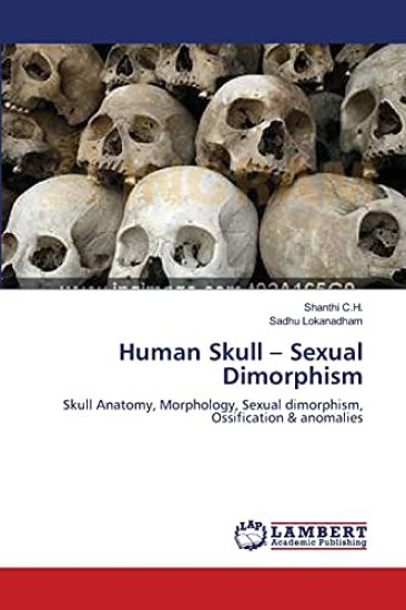 Human Skull - Sexual Dimorphism