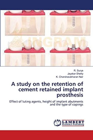 A study on the retention of cement retained implant prosthesis