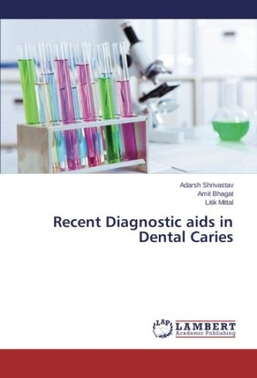 Recent Diagnostic aids in Dental Caries