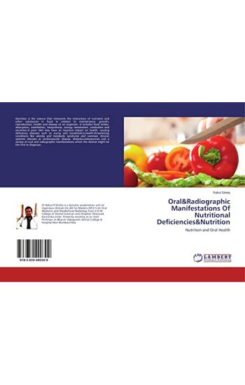 Oral&Radiographic Manifestations Of Nutritional Deficiencies&Nutrition