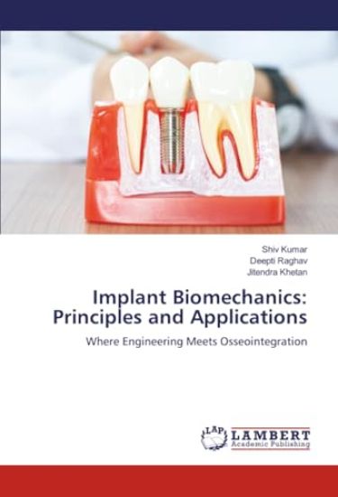 Implant Biomechanics