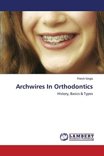Archwires In Orthodontics