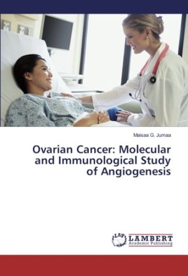 Ovarian Cancer: Molecular and Immunological Study of Angiogenesis