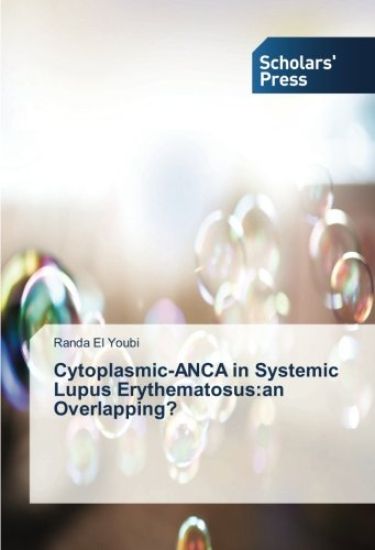Cytoplasmic-ANCA in Systemic Lupus Erythematosus:an Overlapping?