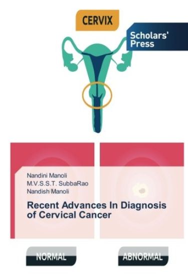Recent Advances In Diagnosis of Cervical Cancer