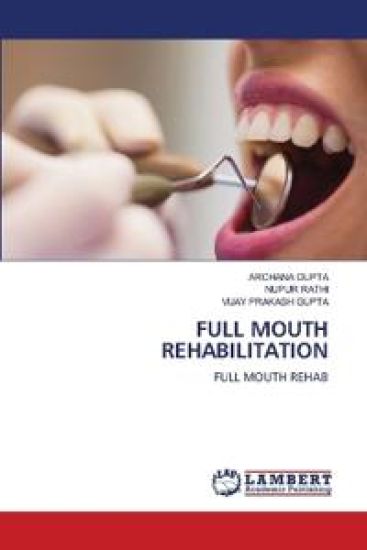 Full Mouth Rehabilitation