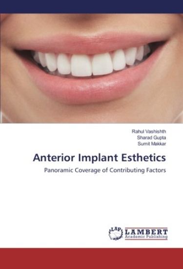 Anterior Implant Esthetics
