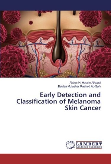 Early Detection and Classification of Melanoma Skin Cancer