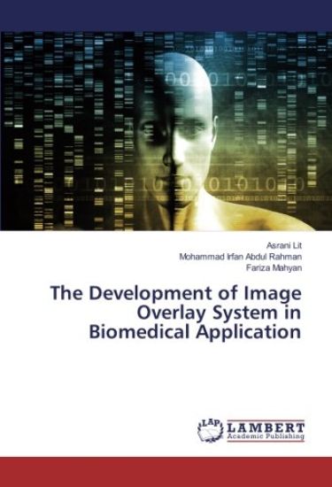 The Development of Image Overlay System in Biomedical Application