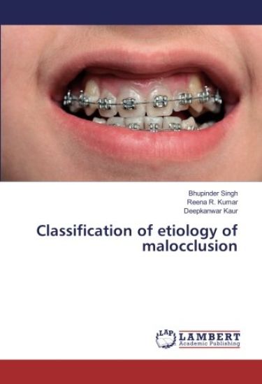 Classification of etiology of malocclusion