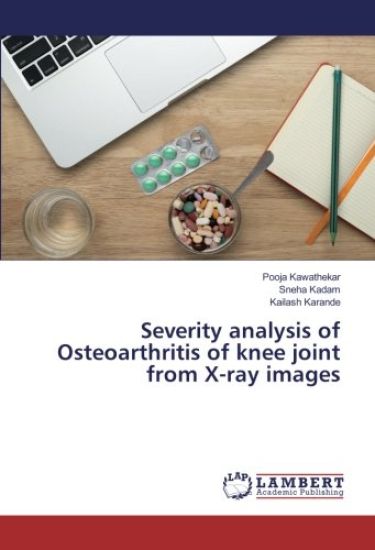 Severity analysis of Osteoarthritis of knee joint from X-ray images