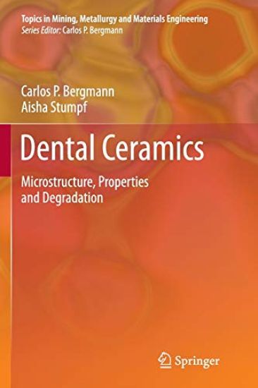 Dental Ceramics