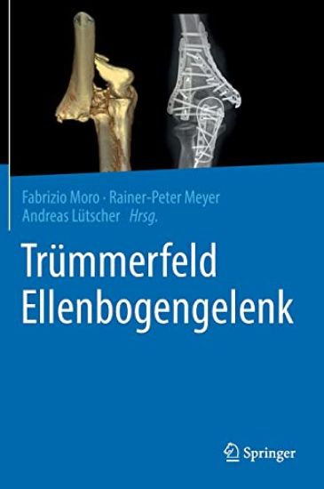 Trümmerfeld Ellenbogengelenk