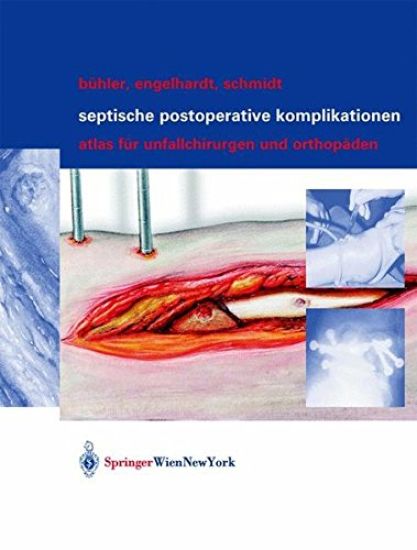 Septische Postoperative Komplikationen: Atlas Für Unfallchirurgen Und Orthopäden