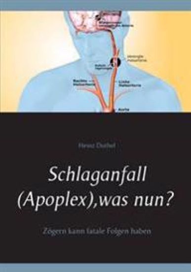 Schlaganfall (Apoplex), was nun?