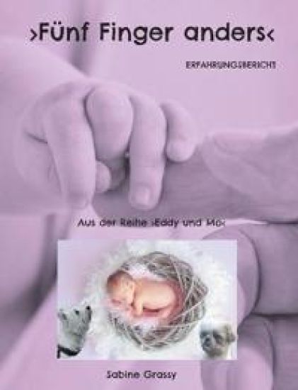 Fünf Finger anders
