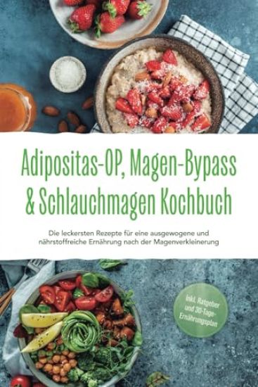 Adipositas-OP, Magen-Bypass & Schlauchmagen Kochbuch: Die leckersten Rezepte für eine ausgewogene und nährstoffreiche Ernährung nach der Magenverkleinerung - inkl. Ratgeber und 30-Tage-Ernährungsplan