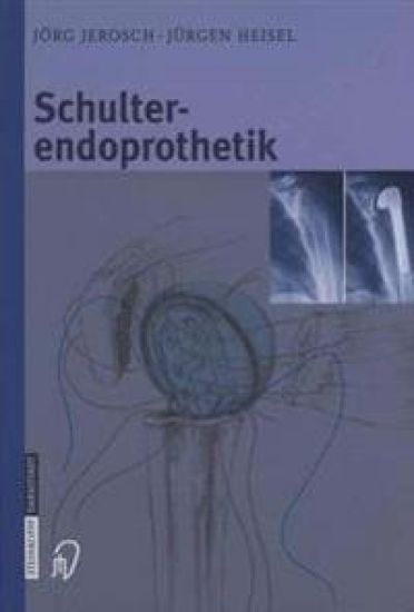 Schulterendoprothetik