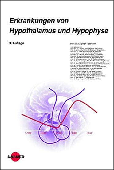 Erkrankungen von Hypothalamus und Hypophyse