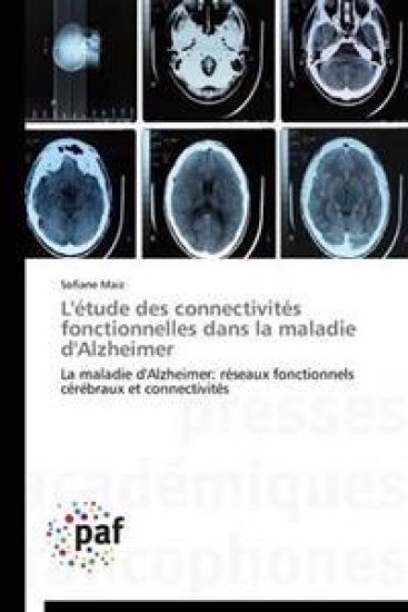 L'Etude Des Connectivites Fonctionnelles Dans La Maladie d'Alzheimer