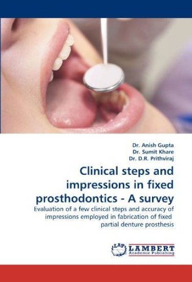 Clinical Steps and Impressions in Fixed Prosthodontics - A Survey